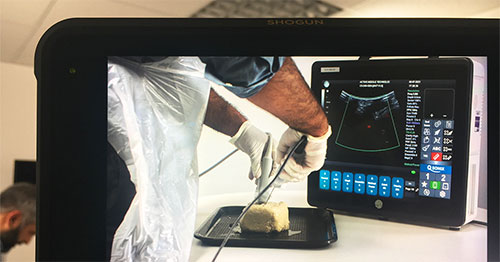 medical procedureon a computer screen